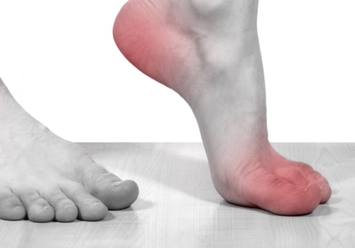 Will cbd oil help neuropathy in feet?